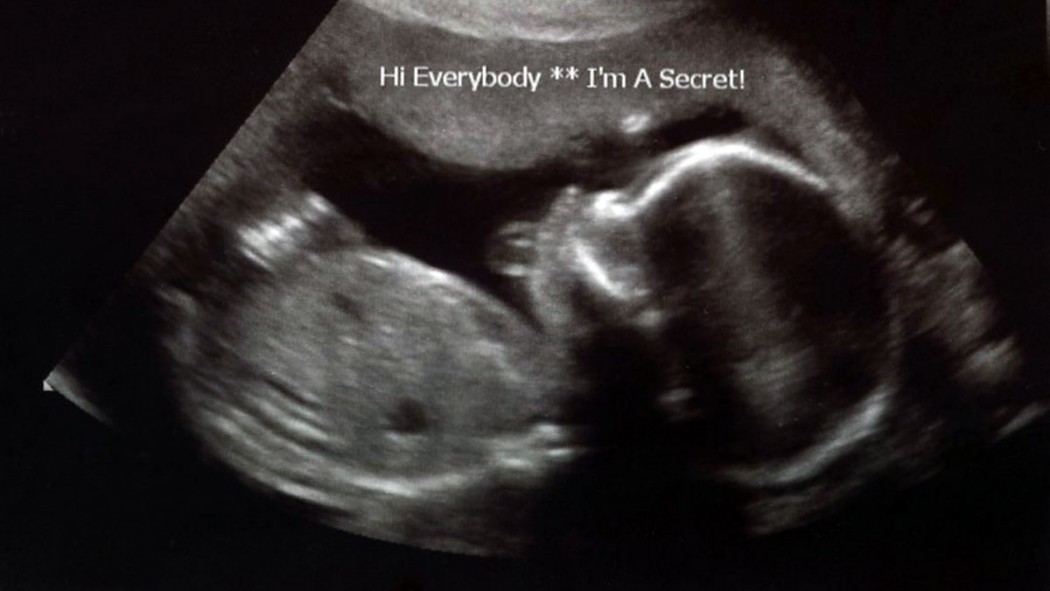 Week 20 Ultrasound - That Poore Baby