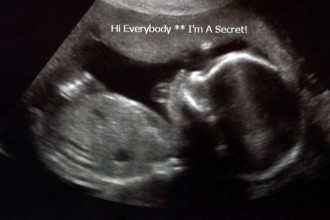 Week 20 Ultrasound - That Poore Baby