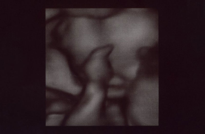 Week 20 Ultrasound in 3D- That Poore Baby